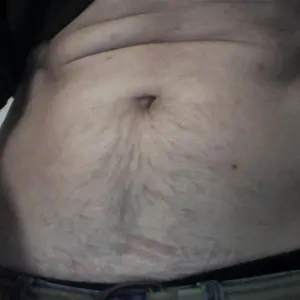 BondeAcces3