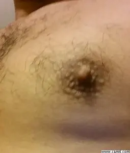 chupametetas