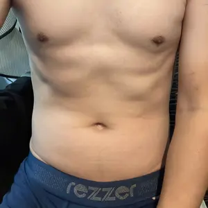 dd7531721721