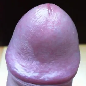 eperis