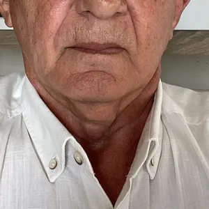 nikorudi