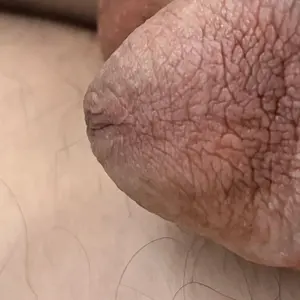 Peter__