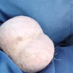 Pilastro999