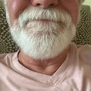 Whitehairdude